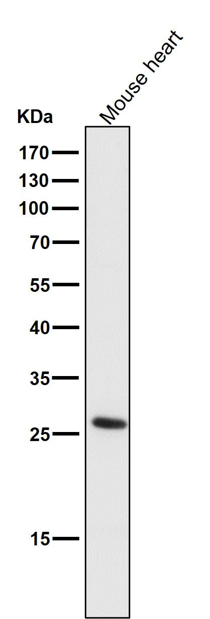 All lanes use the Antibody at 1:5K dilution for 1 hour at room temperature.