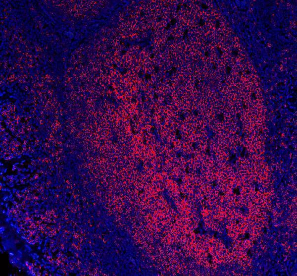 Anti-CD20/MS4A1 Antibody Picoband® (monoclonal, 4I11)