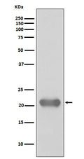 Western blot analysis of Smac/Diablo expression in Jurkat cell lysate.