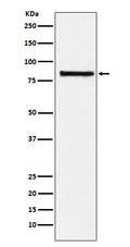 Western blot analysis of eIF2B epsilon expression in Hela cell lysate.