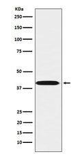 Western blot analysis of LHX3 expression in Jurkat cell lysate.