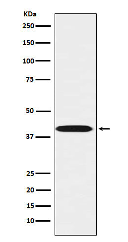 Western blot analysis of LHX3 expression in Jurkat cell lysate.