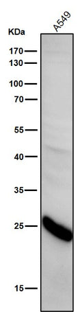 All lanes use the Antibody at 1:1k dilution for 1 hour at room temperature.