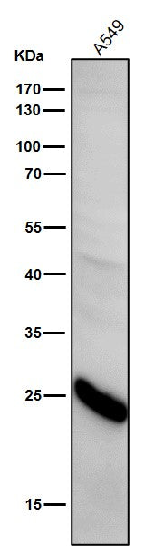 All lanes use the Antibody at 1:1k dilution for 1 hour at room temperature.