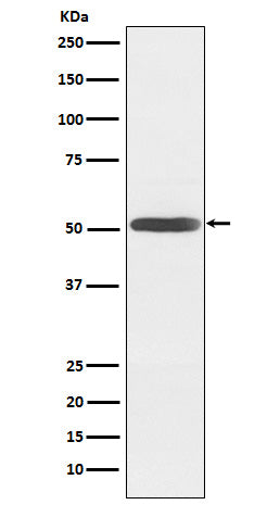 Western blot analysis of Inhibin beta B expression in Mouse brain lysate.