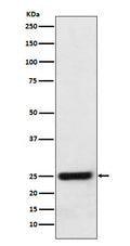 Western blot analysis of ERAB expression in HeLa cell lysate.