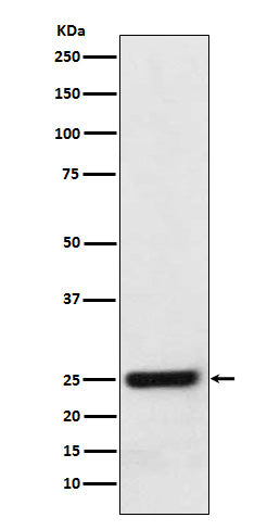 Western blot analysis of ERAB expression in HeLa cell lysate.