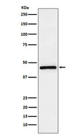 Western blot analysis of TMEFF2 expression in LnCaP cell lysate.