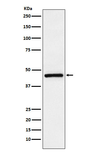 Western blot analysis of TMEFF2 expression in LnCaP cell lysate.