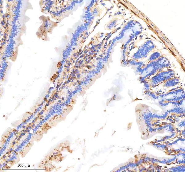 Anti-Destrin Rabbit Monoclonal Antibody