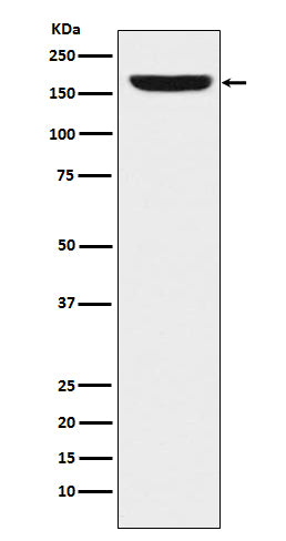 Western blot analysis of REST / NRSF expression in HeLa cell lysate.