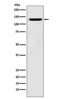 Western blot analysis of PCB expression in HepG2 cell lysate.