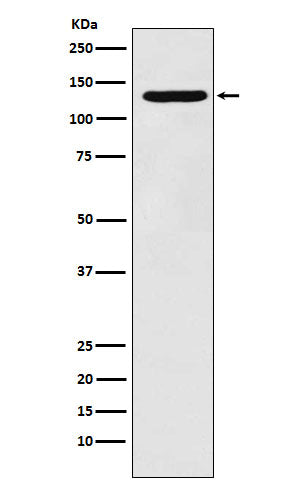 Western blot analysis of PCB expression in HepG2 cell lysate.
