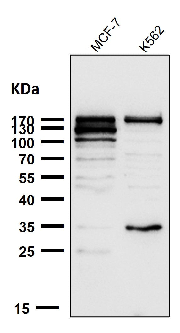 Anti-ATAD2 Rabbit Monoclonal Antibody