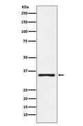 Western blot analysis of KLK2 expression in MOLT4 cell lysate.