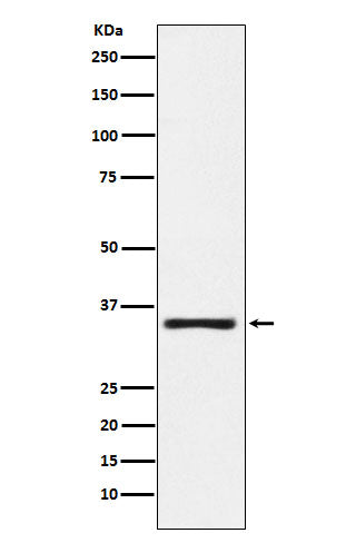 Western blot analysis of KLK2 expression in MOLT4 cell lysate.
