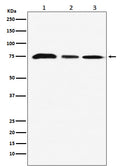 Western blot analysis of KAT7 / HBO1 / MYST2 expression in (1)MCF7 cell lysate; (2) NIH/3T3 cell lysate; (3) C6 cell lysate.