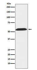 Western blot analysis of TXNRD2 expression in LnCap cell lysate.