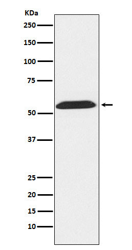 Western blot analysis of TXNRD2 expression in LnCap cell lysate.