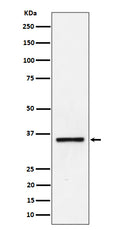 Western blot analysis of Kallikrein 8 expression in Jurkat cell lysate.