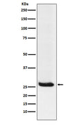 Western blot analysis of Hippocalcin expression in Neuro2a cell lysate.