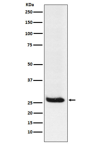 Western blot analysis of Hippocalcin expression in Neuro2a cell lysate.