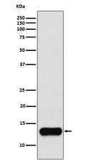 Western blot analysis of Cystatin A expression in K562 cell lysate.