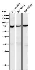 Anti-Perilipin A PLIN1 Rabbit Monoclonal Antibody