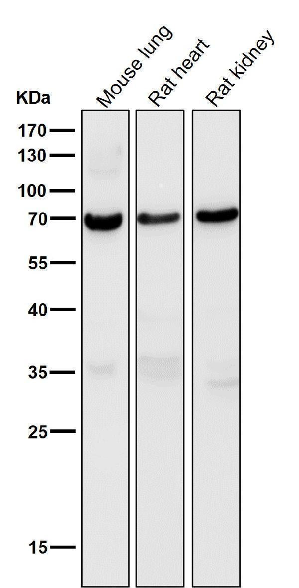 Anti-Perilipin A PLIN1 Rabbit Monoclonal Antibody