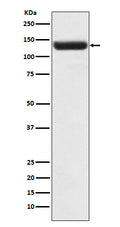 Western blot analysis of ZNF217 expression in Caco2 cell lysate.