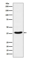 Western blot analysis of VPS26 expression in A431 cell lysate.