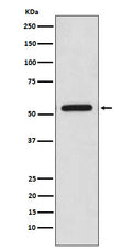 Western blot analysis of CaMKII expression in HeLa cell lysate.