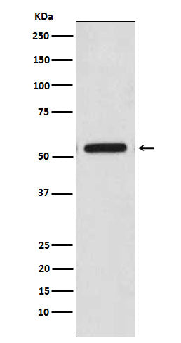 Western blot analysis of CaMKII expression in HeLa cell lysate.