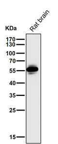All lanes use the Antibody at 1:1K dilution for 1 hour at room temperature.