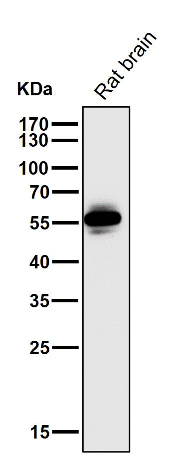 All lanes use the Antibody at 1:1K dilution for 1 hour at room temperature.