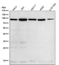 All lanes use the Antibody at 1:1K dilution for 1 hour at room temperature.