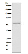 Western blot analysis of AMHR2 expression in SK-OV-3 cell lysate.
