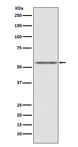 Western blot analysis of AMHR2 expression in SK-OV-3 cell lysate.