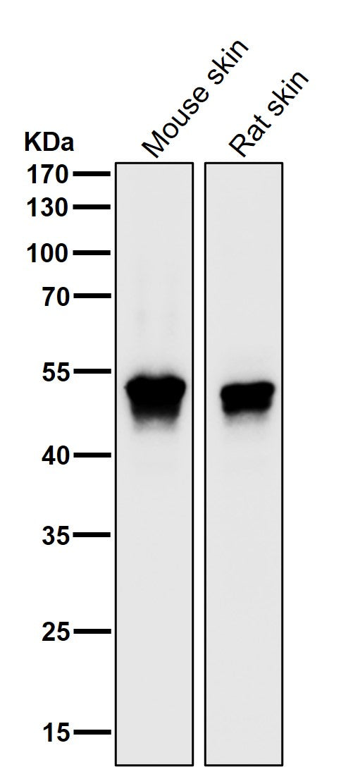 All lanes use the Antibody at 1:2K dilution for 1 hour at room temperature.