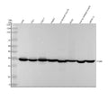 Anti-Pyruvate Dehydrogenase E1 beta subunit PDHB Monoclonal Antibody