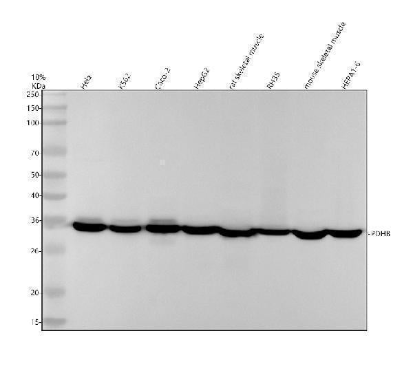 Anti-Pyruvate Dehydrogenase E1 beta subunit PDHB Monoclonal Antibody