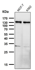 All lanes use the Antibody at 1:3K dilution for 1 hour at room temperature.