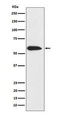 Western blot analysis of CK6 expression in A431 cell lysate.