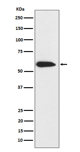 Western blot analysis of CK6 expression in A431 cell lysate.