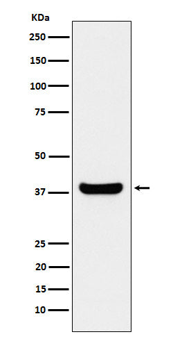 Western blot analysis of Protein Phosphatase 1 beta expression in Jurkat cell lysate.