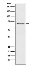 Western blot analysis of GABA A Receptor beta 2 expression in A549 cell lysate.