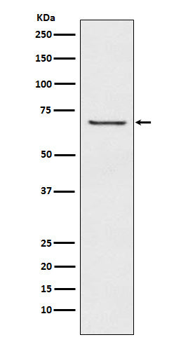 Western blot analysis of GABA A Receptor beta 2 expression in A549 cell lysate.