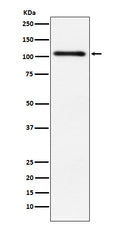 Western blot analysis of Protein Kinase D2 expression in HeLa cell lysate.