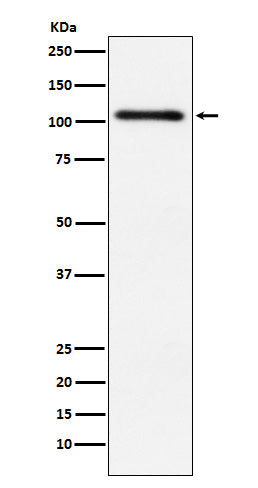 Western blot analysis of Protein Kinase D2 expression in HeLa cell lysate.