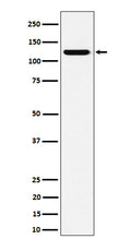 Western blot analysis of PKN2 expression in HeLa cell lysate.